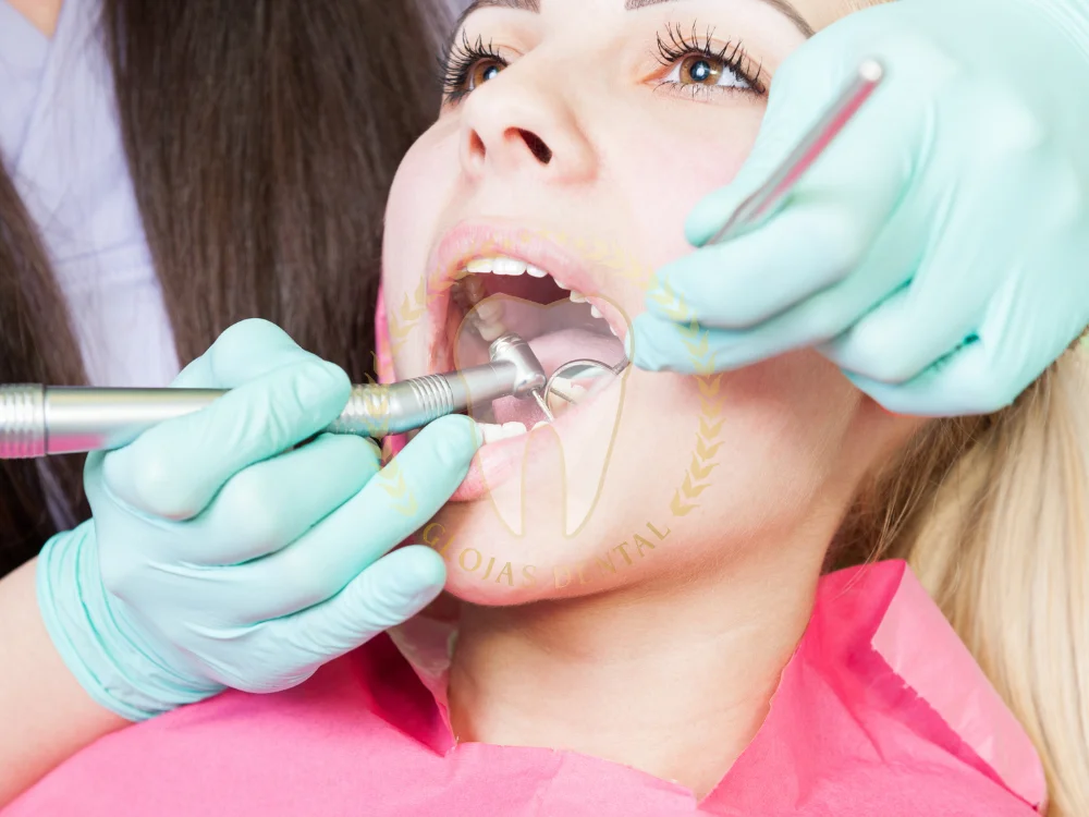 dental-tartar-removal