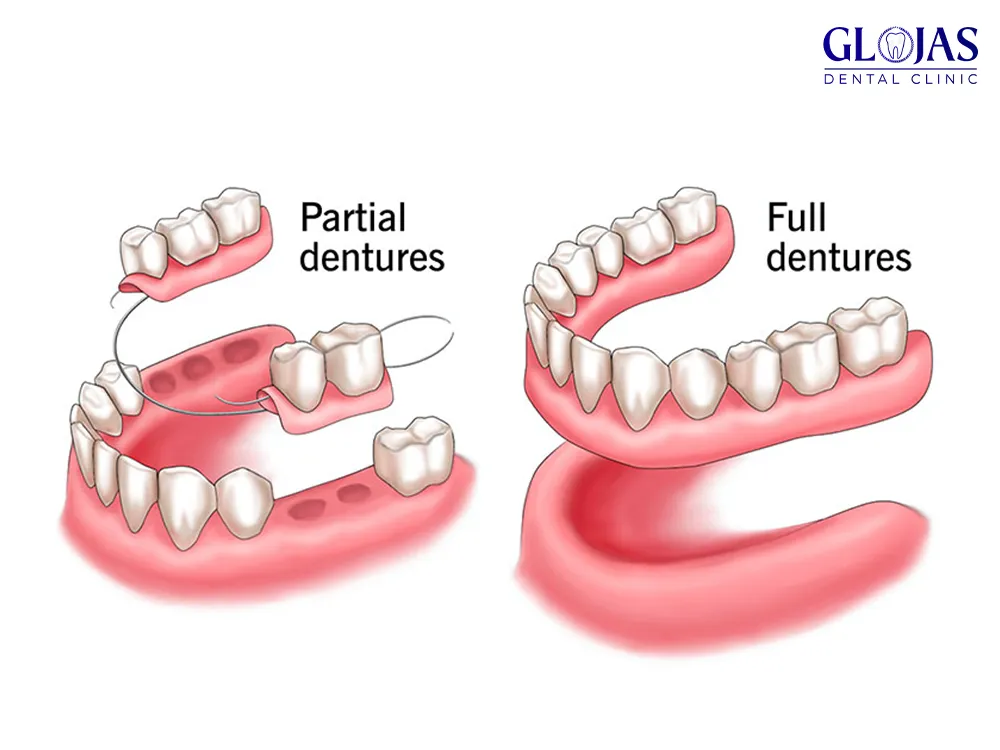 dentures-dental-clinic-malaysia-klinik-pergigian-kuala-lumpur