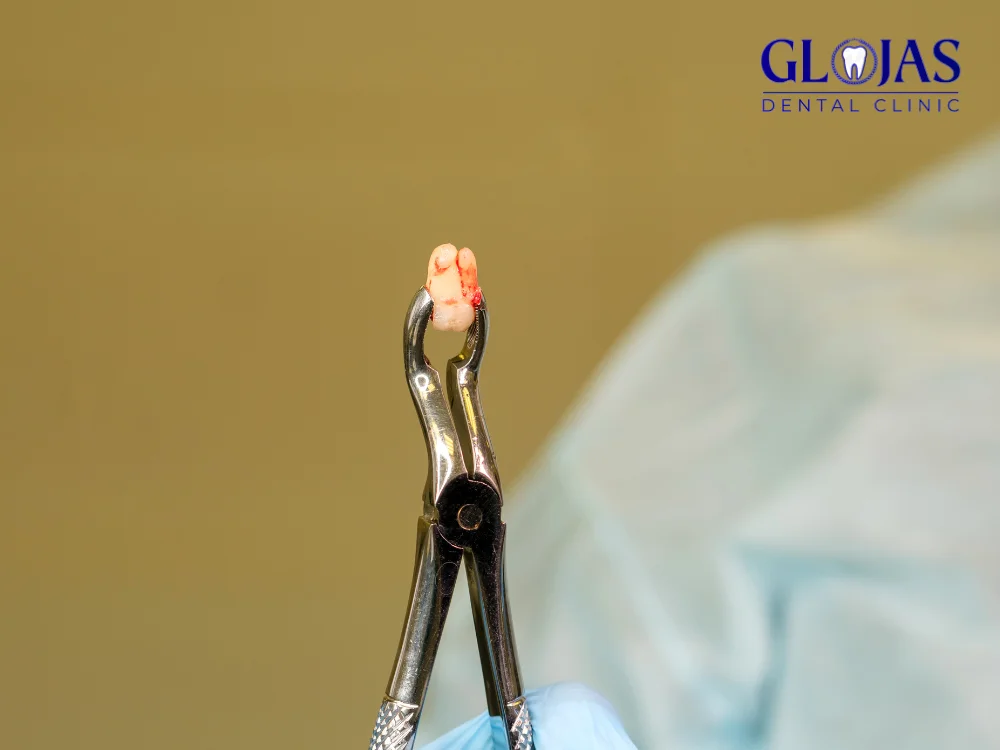 5 Critical Facts About Molar Removal You Need to Know! 9 molar-removal