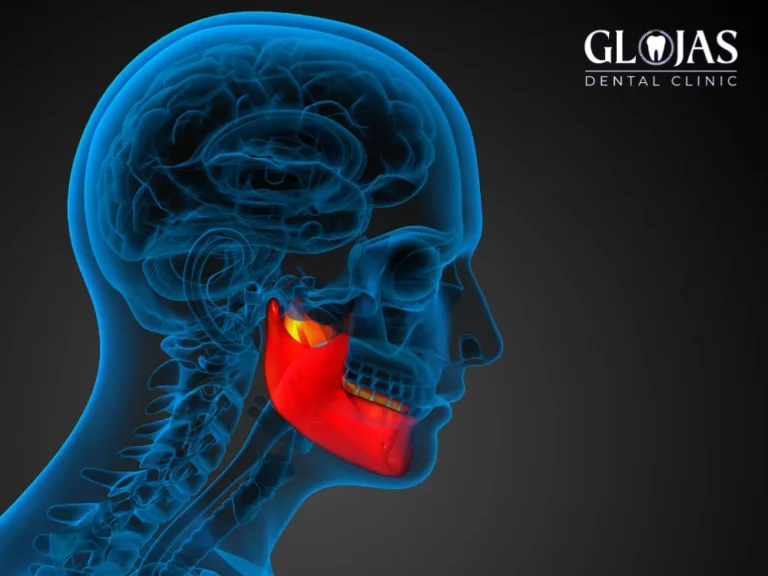 orthognathic-jaw-surgery