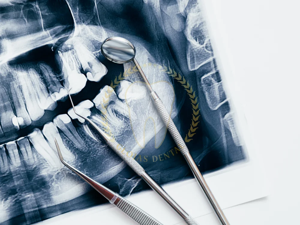 orthognathic-jaw-surgery