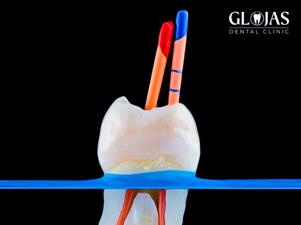 RCT Treatment Cost: 10 Key Insights About Affordable Smile 11 rct-treatment-cost