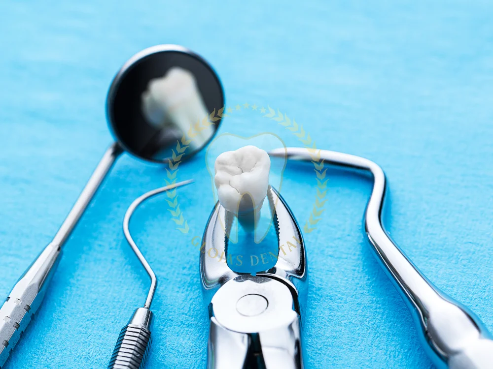 tooth-extraction-surgery