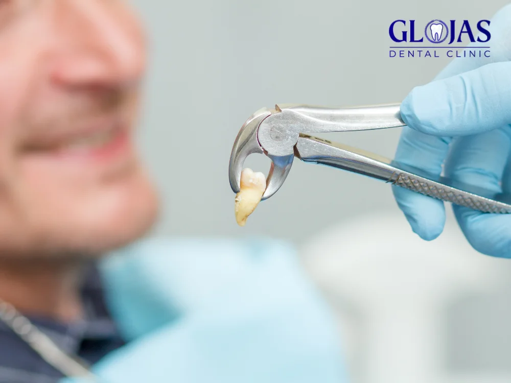 Tooth Extraction Surgery: 7 Key Facts to Consider 31 tooth-extraction-surgery