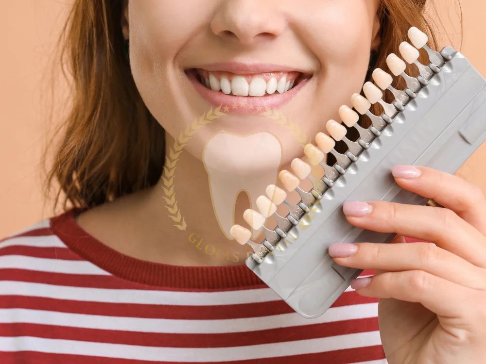composite-veneers-cost