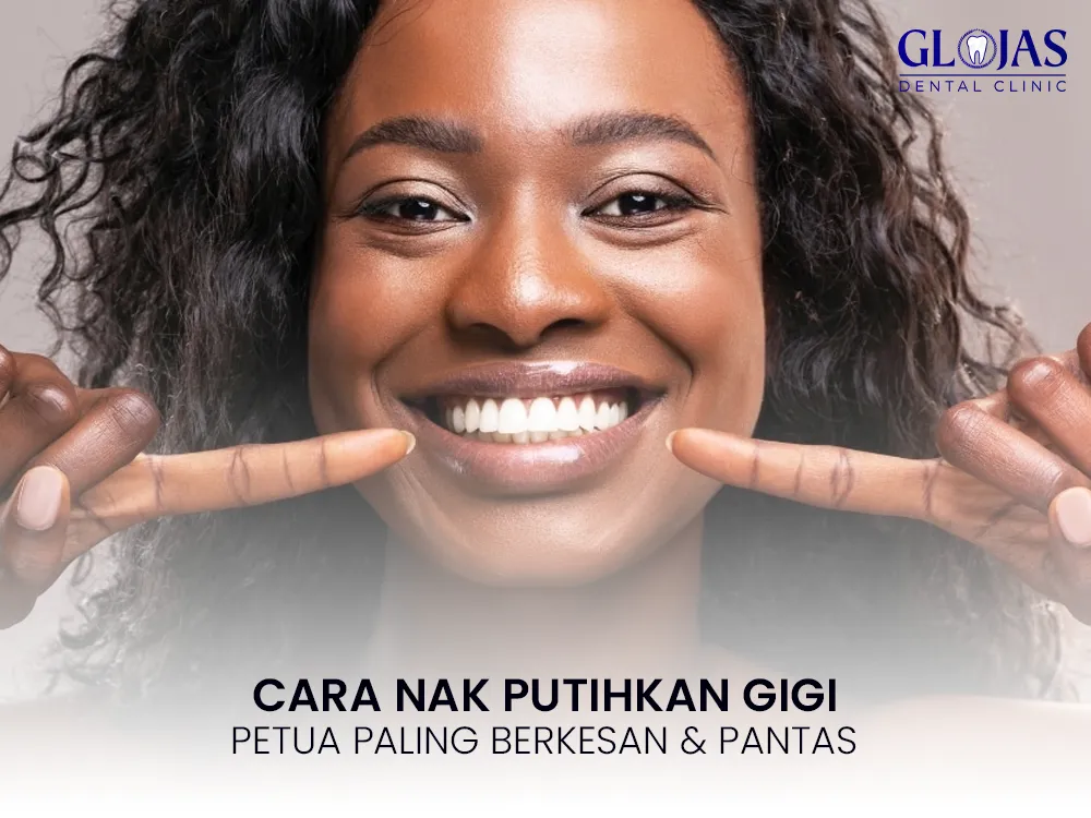 putihkan-gigi-paling-berkesan