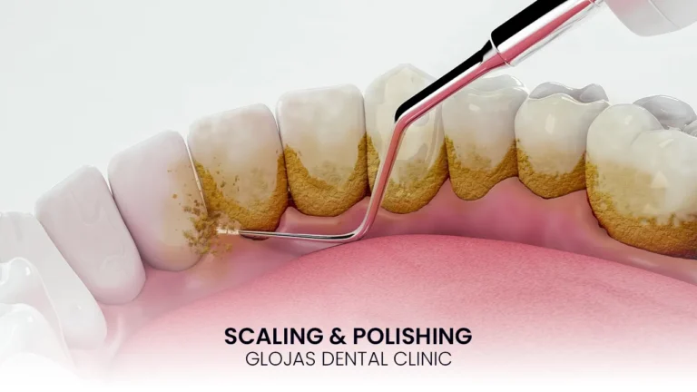 scaling polishing kl dental clinic malaysia