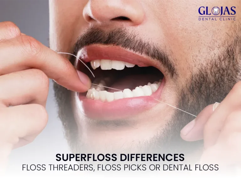 superfloss-dental-clinic-floss-teeth