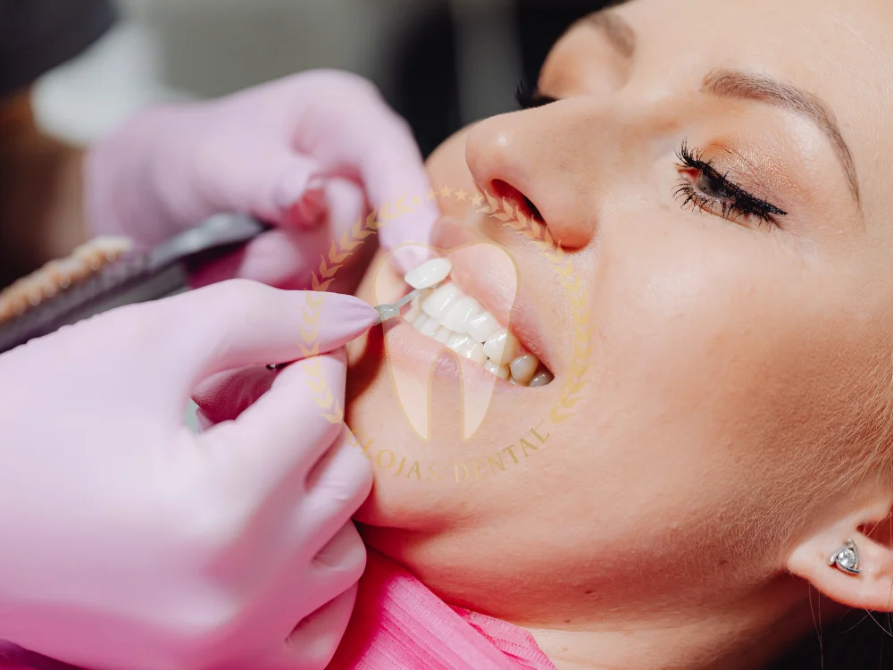 teeth-veneers-cost
