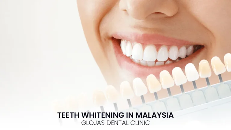 teeth-whitening-malaysia-clinic-dental-kl