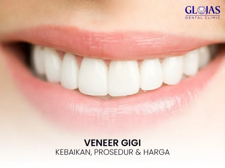 veneer-gigi-malaysia