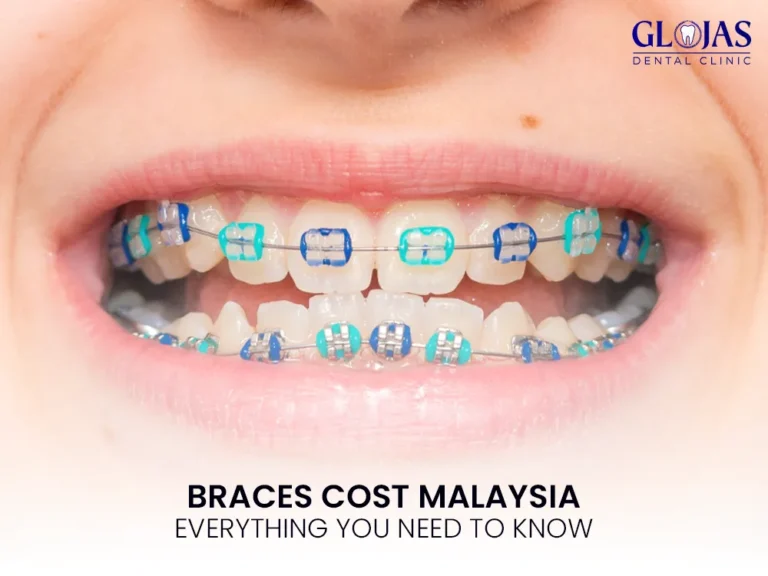 braces-cost-malaysia