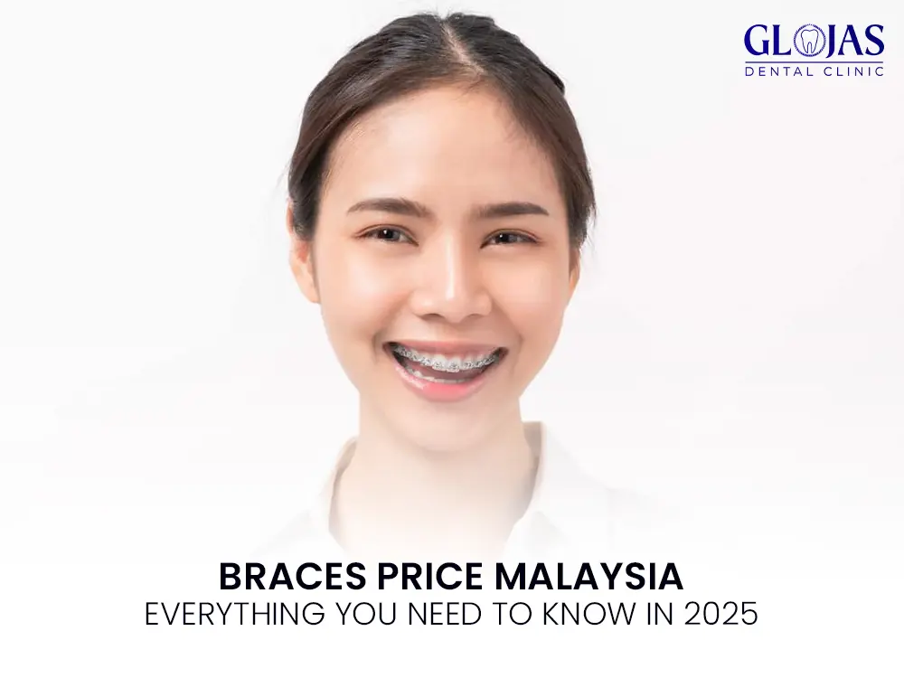braces-price-malaysia-cost-damon-invasalign-ceramic-braces-2025