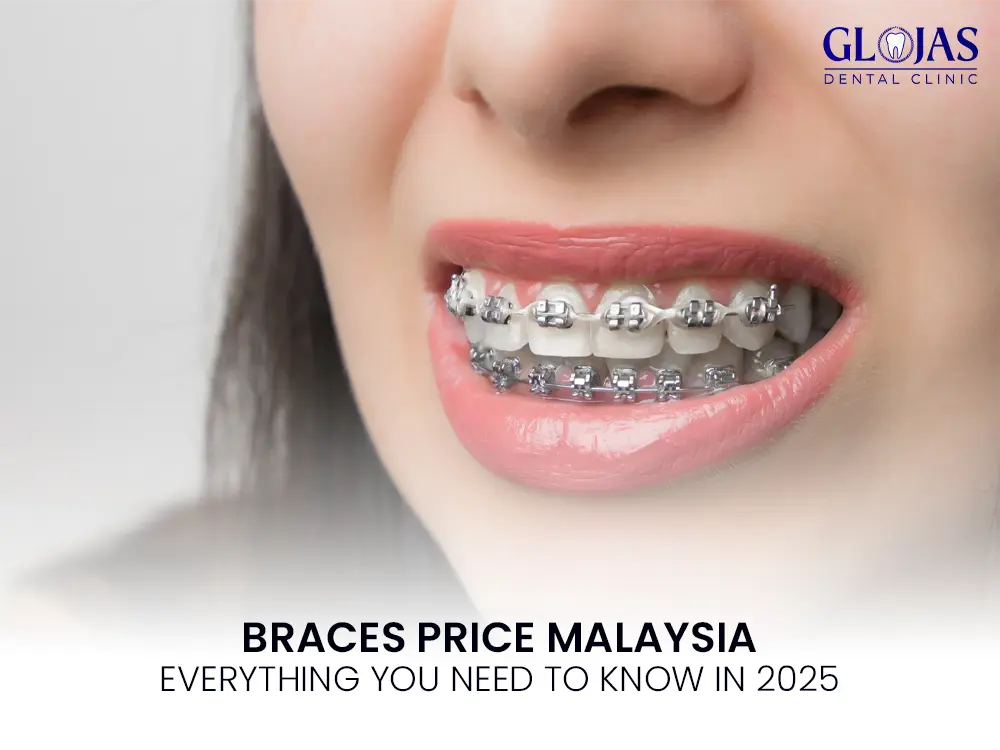 braces-price-malaysia-cost-damon-invasalign-ceramic-braces