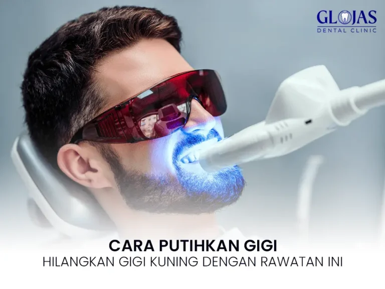 cara-putihkan-gigi-kuning-tips