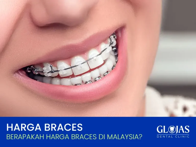 harga-braces-malaysia-braces-price-2025