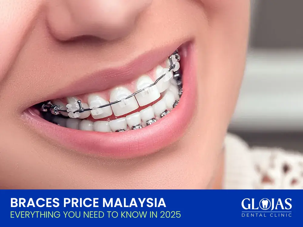 harga-braces-malaysia-braces-price-2025