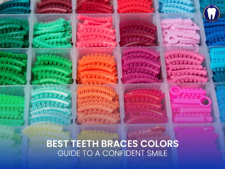 Teeth-Braces-Colors