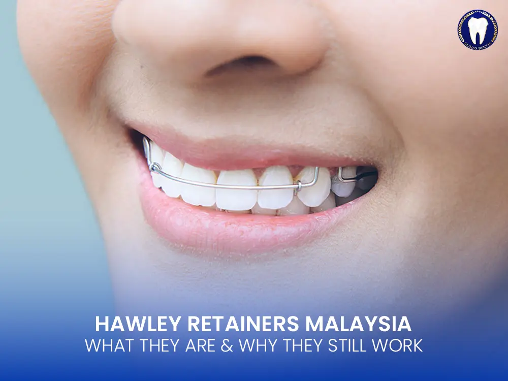 hawley-retainers-malaysia