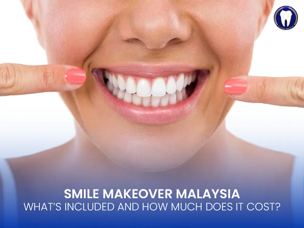 smile-makeover-malaysia-cost-price