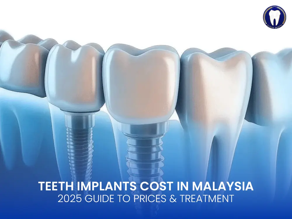 teeth-implants-cost-malaysia