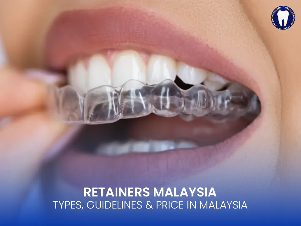 teeth-retainer-malaysia