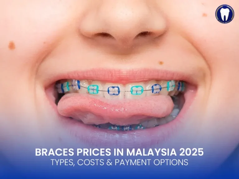 braces-prices
