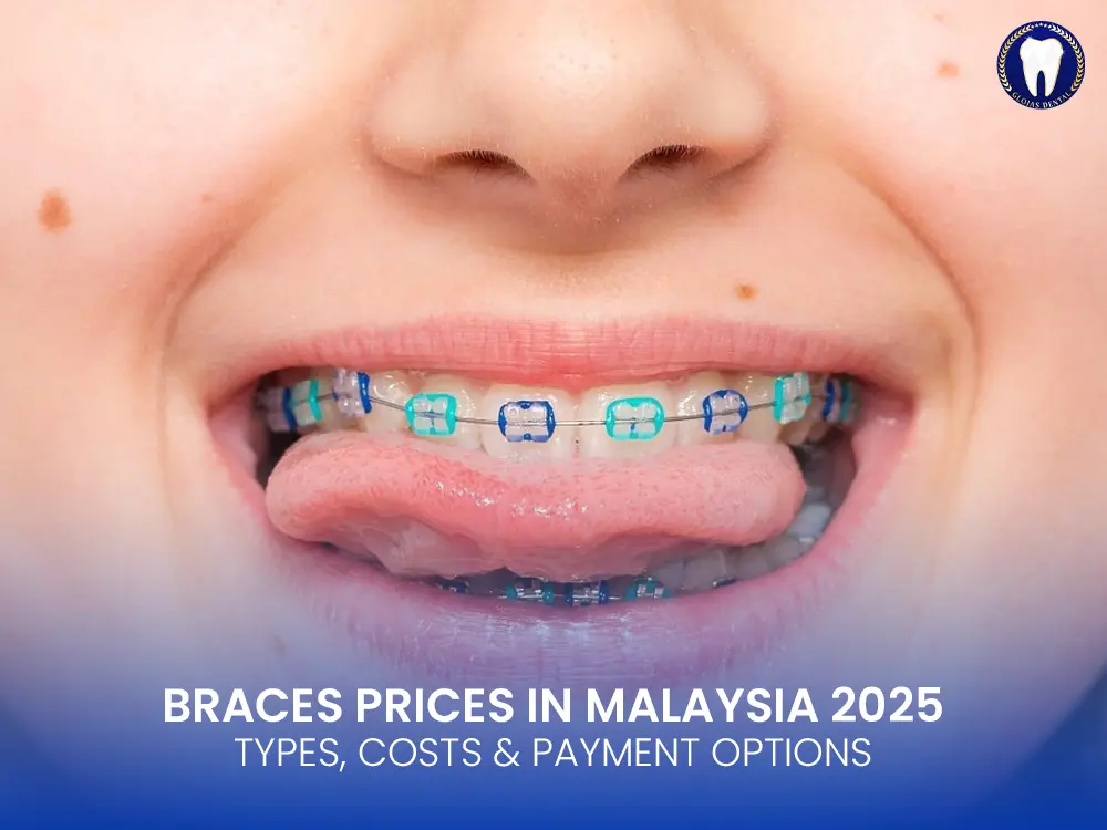 braces-prices