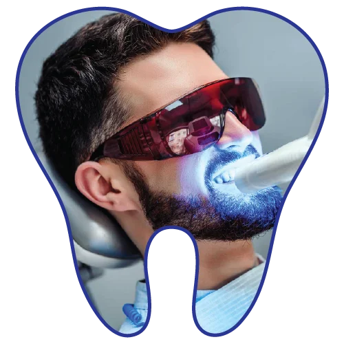 teeth-whitening-dental-clinic-kuala-lumpur-malaysia