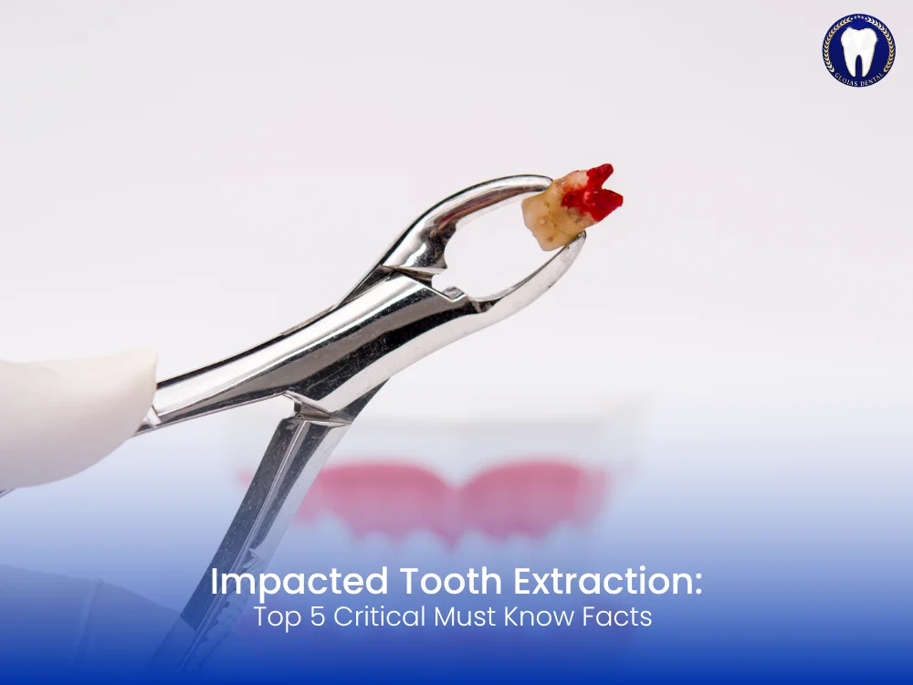 impacted-tooth-extraction