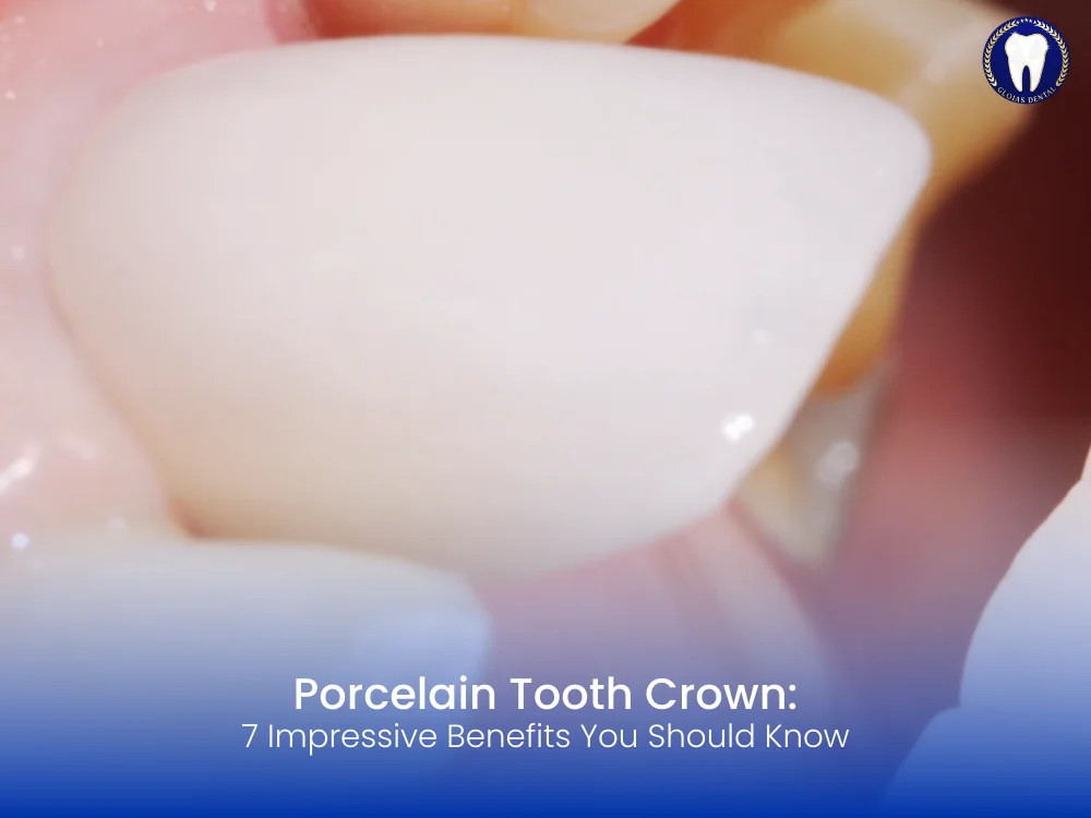 porcelain-tooth-crown