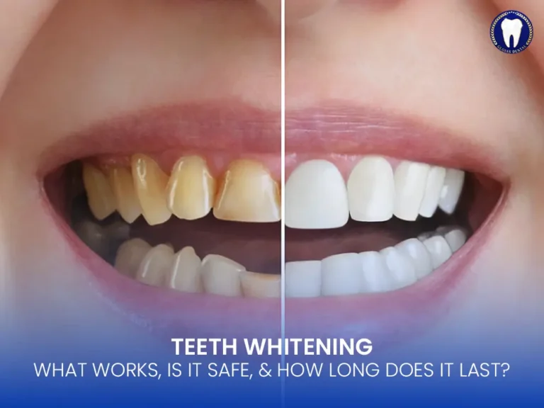 teeth-whitening