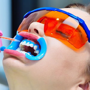teeth-whitening-in-house