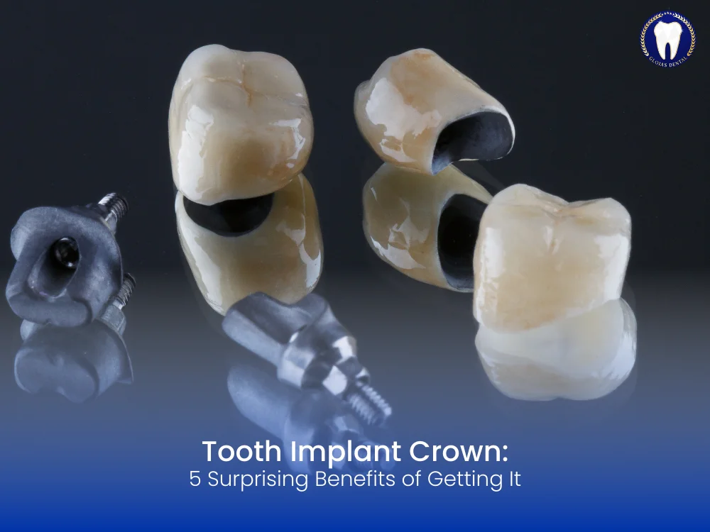 tooth-implant-crown