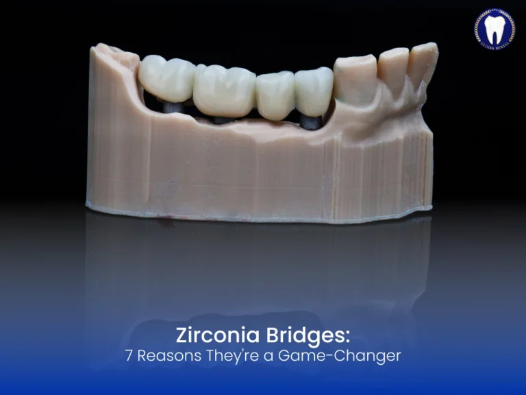zirconia-bridges