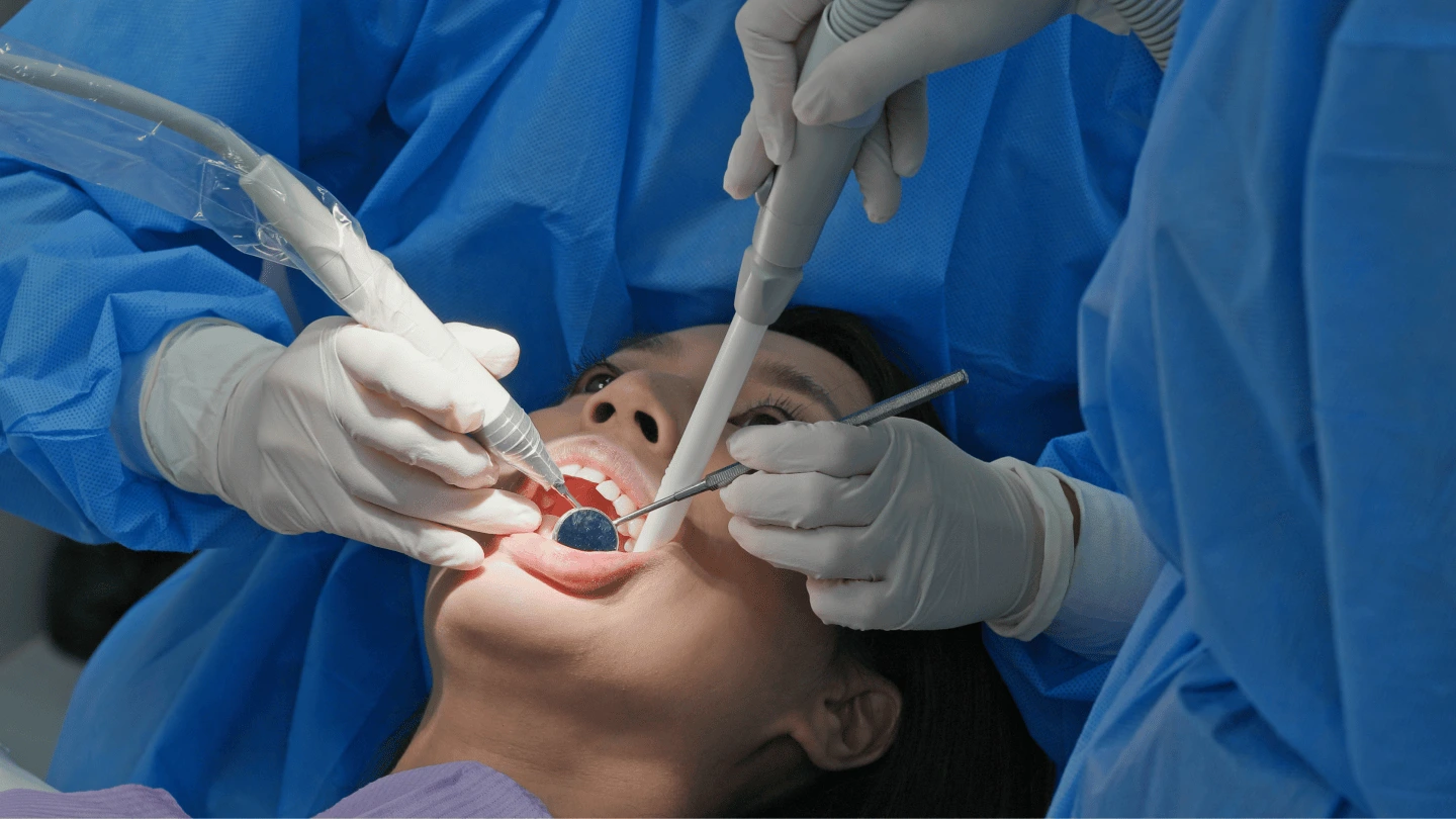 scaling-gigi-prosedur