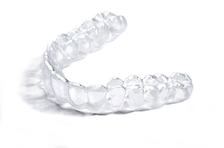clear-aligners-transparent-braces-kuala-lumpur