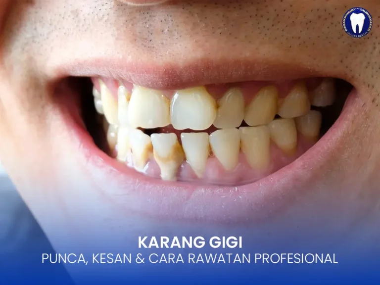 karang-gigi