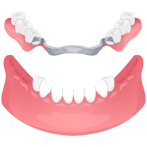 partial-dentures-glojas