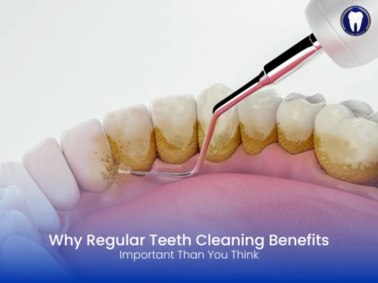 teeth-cleaning-benefits-kl