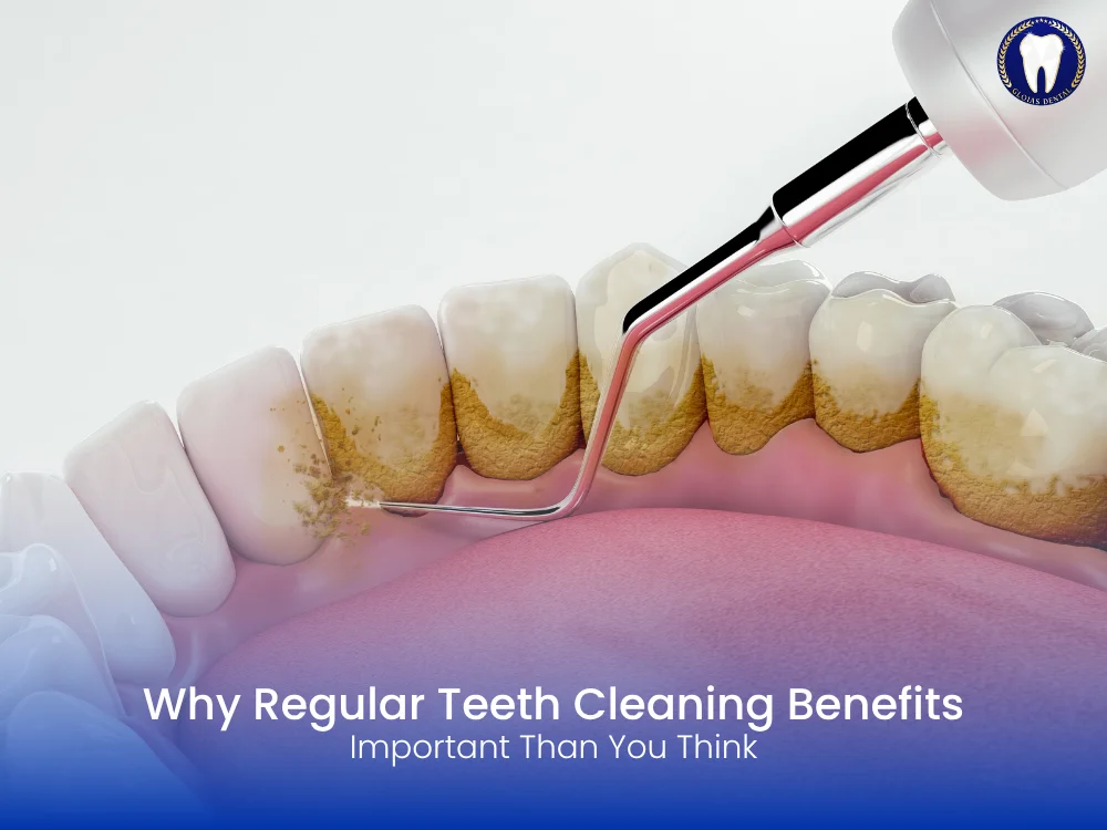 teeth-cleaning-benefits-kl