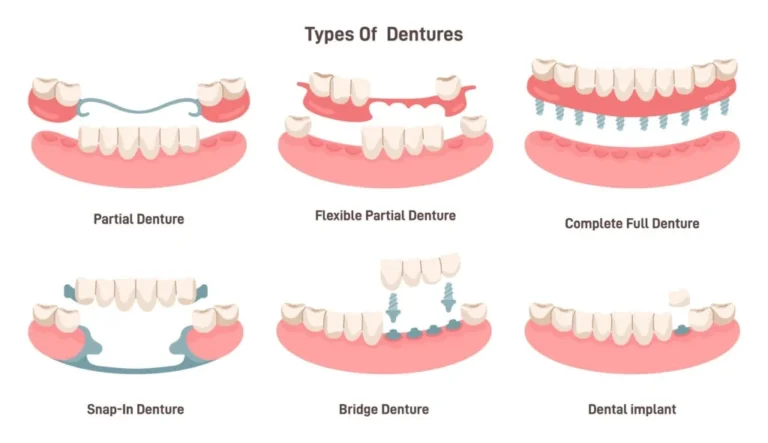 dentures-kuala-lumpur-malaysia