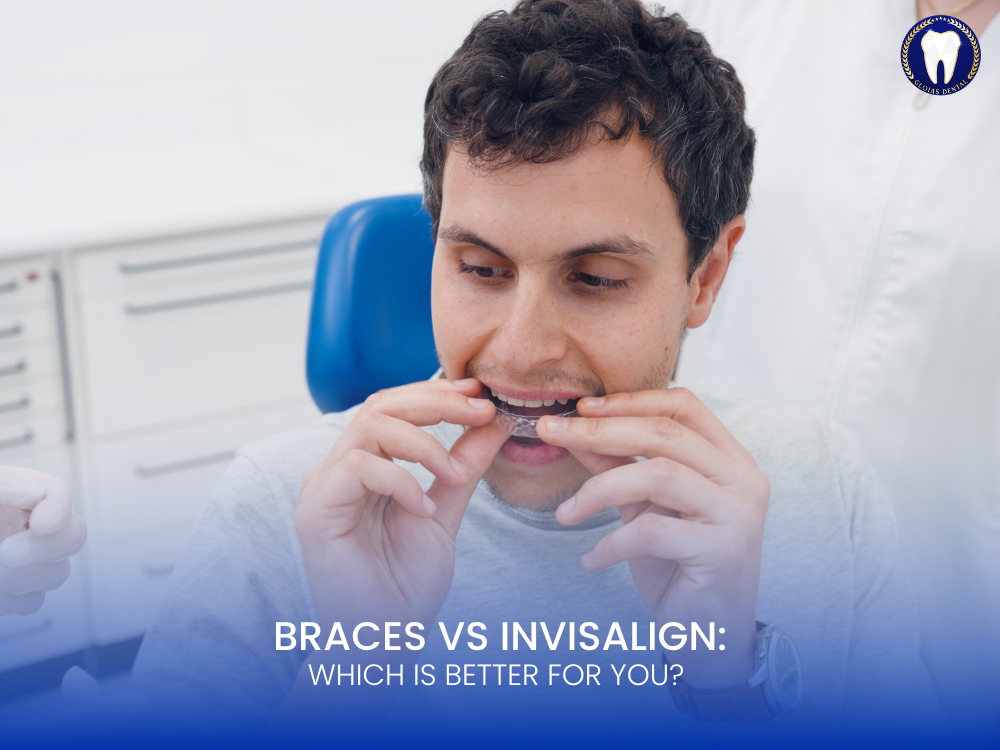 braces-vs-invisalign
