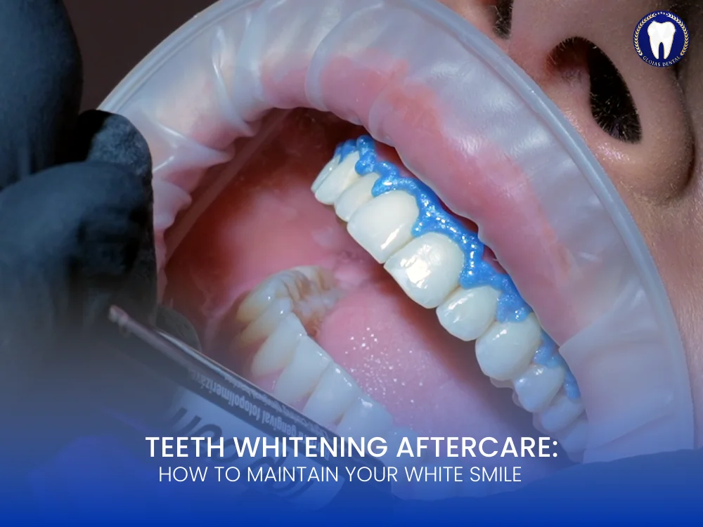 teeth-whitening-aftercare